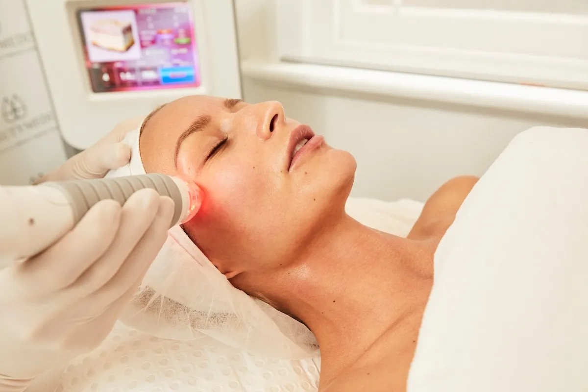 Vivace Radiofrequency Skin Tightening